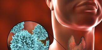 Người đàn ông 35 tuổi đau họng t:uvo:::ng sau 5 lần hóa trị, bác sĩ khẩn cầu: Vứt 2 thứ trong tủ lạnh đi