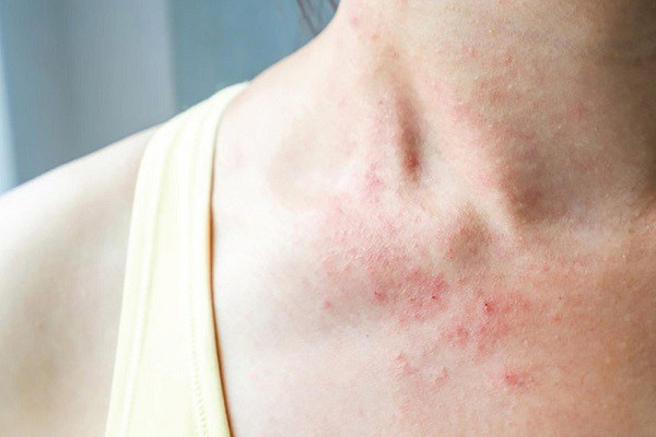 32 tác dụng tuyệt vời của lá trầu không ít người biết đến - 6
