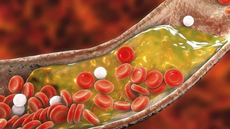 Vitamin A và C trong tầm bóp giúp hạ cholesterol máu