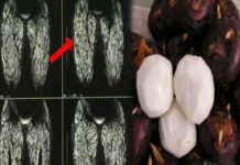 Ăn 1 miếng đã không tốt mà nhiều người cứ vô tư ăn