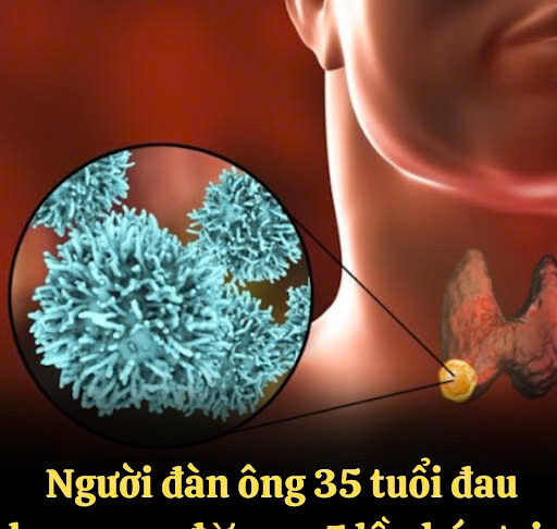 Người đàn ông 35 tuổi đau họng t:uvo:::ng sau 5 lần hóa trị, bác sĩ khẩn cầu: Vứt 2 thứ trong tủ lạnh đi