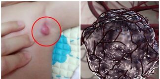 9 triệu chứng ‘điển hình’ báo hiệu trẻ nhỏ bị ung thư giai đoạn đầu: Mẹ đưa con đến viện ngay