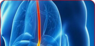 7 dấu hiệu u ng th ư dạ dày giai đoạn sớm, ai cũng cần biết kẻo di căn xa