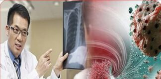 Sau nhiều năm, BS nhận ra bệnh nhân u;ng th;ư luôn có 6 điểm chung vào buổi sáng: Ngẫm lại quá đúng