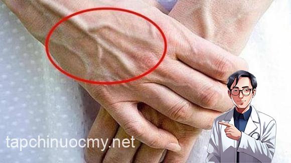 Một số người có gân xanh nổi lên trên tay, một số thì không! Vậy người nào thể hiện sức khỏe tốt hơn?