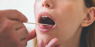 5 dấu hiệu ở miệng cảnh báo u ng th ư, thấy đau phải đi khám ngay kẻo hối không kịp