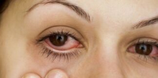 3 dấu hiệu ở mắt cảnh báo đột quỵ, UT ‘ghé thăm’