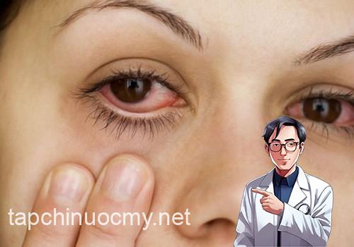 Những bệnh lý thể hiện qua đôi mắt của bạn