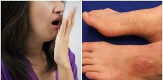 8 biểu hiện của suy thận nếu bỏ qua có thể phải chạy thận cả đời: Hôi miệng dù đã đánh răng sạch sẽ