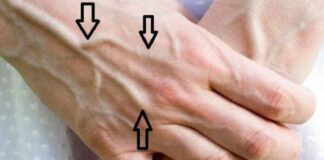 Nhìn thấy ai có “gȃn xanh” nhất định phải nói cho họ biḗt điều nàу, vì sẽ cứu sṓng họ đấy