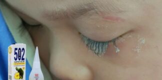 Bé trai 3 tuổi bị keo 502 bắn vào mắt, hành động của người mẹ trong “30 giây vàng” đã cứu con khỏi cảnh m;ù lo;à!