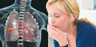 6 chỗ đau trên người cảnh báo U-ng Thư giai đoạn đầu: Đừng chần chừ kẻo di căn xa