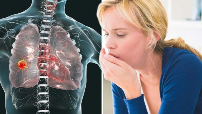 5-dau-hieu-ung-thu-phoi-giai-doan-dau-khong-the-bo-qua-5