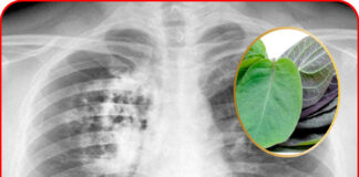 Dùng 1 nắm lá mơ lông, phổi viêm trắng phếu cũng khỏi sau 1 tuần, hiệu quả khiến ai cũng bất ngờ