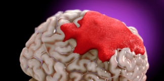 Con trai 6 tuổi vừa ngủ dậy bị đột q:u-ỵ, bác sĩ nhấn mạnh 4 dấu hiệu cha mẹ cần nắm rõ để cứu con