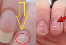 Gan khỏe hay yếu cứ nhìn xuống ngón tay giữa là biết, không có cả 3 dấu hiệu chứng tỏ gan rất tốt