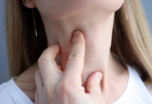 Người phụ nữ 54 tuổi phát hiện ung thư tuyến giáp từ dấu hiệu nhiều người bỏ qua