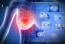 “3 đen” xuất hiện trên cơ thể báo hiệu bệnh K rất gần, gặp bác sĩ ngay