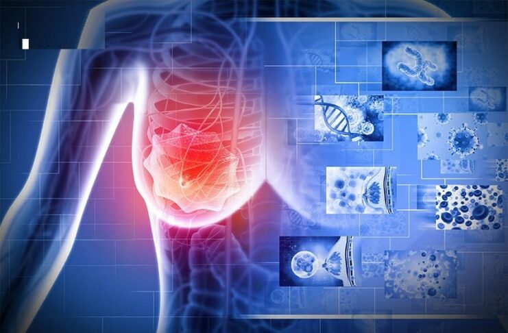 “3 đen” xuất hiện trên cơ thể báo hiệu bệnh K rất gần, gặp bác sĩ ngay