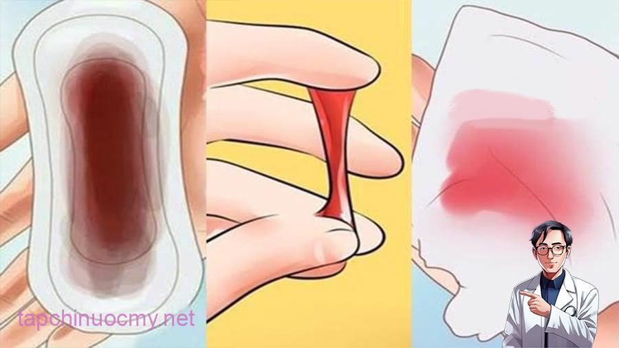 dau-hieu-ung-thu-co-tu-cung