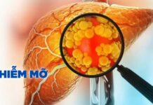 Khỏi hẳn g:an nhiễm mỡ nhờ làm điều này mỗi ngày, bác sĩ nói: ‘Rất đơn giản, không tốn tiền’