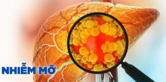 Khỏi hẳn g:an nhiễm mỡ nhờ làm điều này mỗi ngày, bác sĩ nói: ‘Rất đơn giản, không tốn tiền’