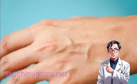 gȃn xanh, gȃn xanh ʟà dấu hiệu bệnh gì