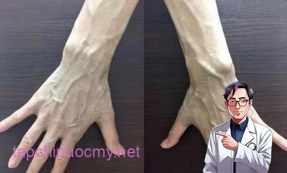 gȃn xanh, gȃn xanh ʟà dấu hiệu bệnh gì