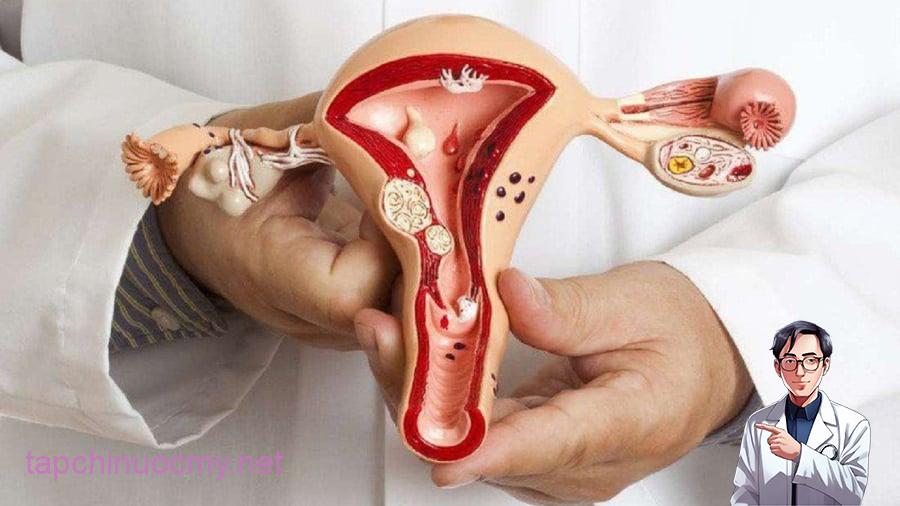 ung-thu-co-tu-cung-ti-le-song-va-phuong-phap-dieu-tri-1