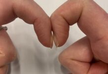 Đặt 2 đầu ngón tay trỏ sát nhau để biết mình bị ung thư phổi không: Cách thử nhanh BS cũng công nhận