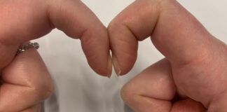 Đặt 2 đầu ngón tay trỏ sát nhau để biết mình bị ung thư phổi không: Cách thử nhanh BS cũng công nhận