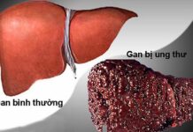 Vạch mặt th:ủ ph:ạm số 1 khiến ung thư tăng vọt tại Việt Nam, nhiều người đang rước “nó” vào nhà mà không ngờ