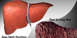 Vạch mặt th:ủ ph:ạm số 1 khiến ung thư tăng vọt tại Việt Nam, nhiều người đang rước “nó” vào nhà mà không ngờ