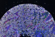 Đột phá: T-h-u-ố-c mới đánh bại cả tế bào u ng thư “tàng hình”