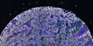 Đột phá: T-h-u-ố-c mới đánh bại cả tế bào u ng thư “tàng hình”