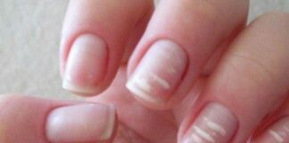 Nhìn móng tay đoán sức khỏe, kiểm tra ngay xem bạn đang ở tình trạng nào