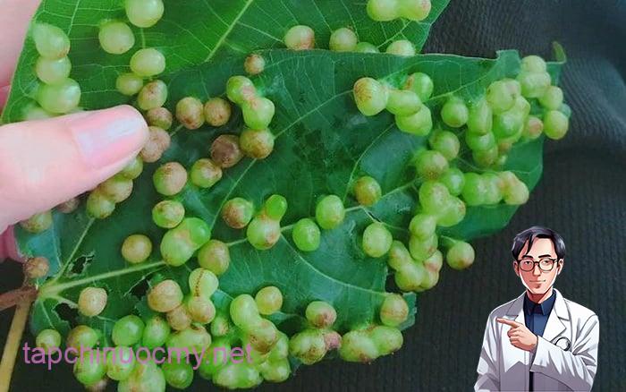 Dù những nốt sần không độc, nhưng có một số trường hợp bạn vẫn nên thận trọng