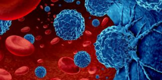 Cảnh báo 2 thực phẩm “châm ngòi” mạnh nhất cho UT