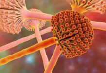 ‘Nguyên nhân lớn nhất gây ung thư gan’ đã được tìm thấy, cao gấp 10 lần so với thuốc lá và rượu. Thủ phạm là ‘nó’