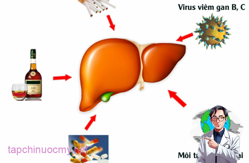 ung-thu-gan2-1527911585744242502810