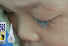 Bé trai 3 tuổi bị keo 502 bắn vào mắt, hành động của người mẹ trong “30 giây vàng” đã cứu con khỏi cảnh mù loà!