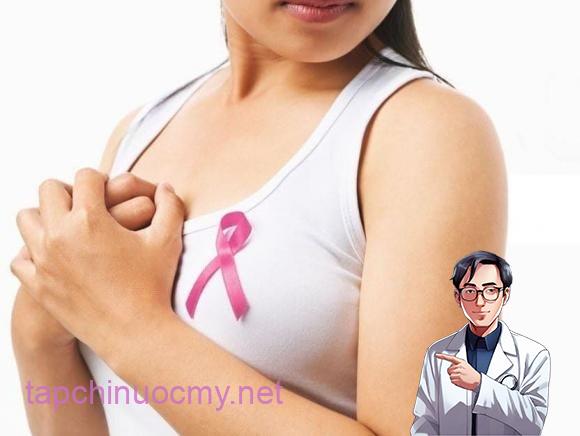 Ung thư biểu mô ống dẫn sữa tại chỗ (DCIS) là giai đoạn rất sớm của ung thư vú, khi các tế bào ung thư chỉ nằm trong các ống dẫn sữa và chưa xâm nhập qua màng đáy. 