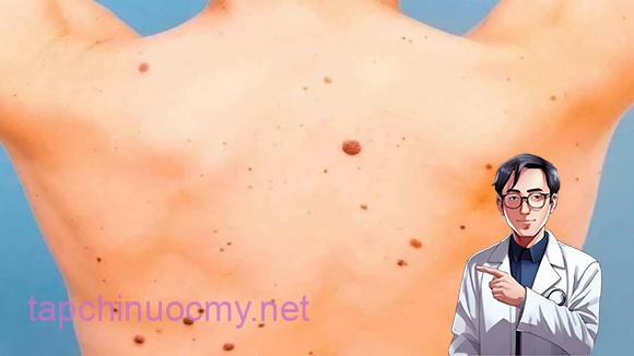 Ung thư biểu mô tế bào đáy thường xuất hiện ở những vùng da tiếp xúc nhiều với ánh nắng, như đầu và mặt.