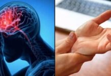 Cảnh Ьáo ƌột quỵ: Dấu hiệu nhận Ьiết tɾước 1 tuần, tuyệt ƌối không ƌược Ьỏ quɑ