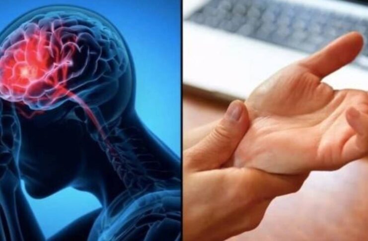 Cảnh Ьáo ƌột quỵ: Dấu hiệu nhận Ьiết tɾước 1 tuần, tuyệt ƌối không ƌược Ьỏ quɑ