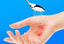 Chỉ với một ít đường bạn có thể trị được ngay vết thương lở loét