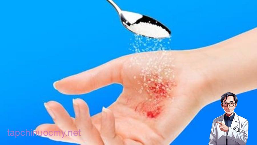 Rắc đường trắng lên vết loét trước khi băng có tác dụng tiêu diệt vi khuẩn ngăn cản quá trình hồi phục và gây ra cơn đau. (Ảnh minh họa)