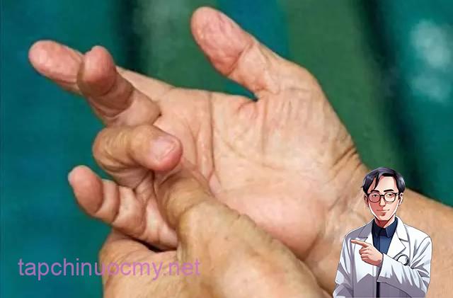 4 thay đổi ở ngón tay có thể là dấu hiệu ung thư phổi, hãy đi khám ngay!- Ảnh 6.