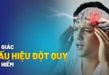 Dấu hiệu đột quỵ trước 1 tuần: Nhận biết sớm để tránh biến chứng ng.uy hiểm