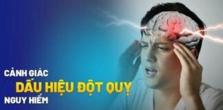 Dấu hiệu đột quỵ trước 1 tuần: Nhận biết sớm để tránh biến chứng ng.uy hiểm